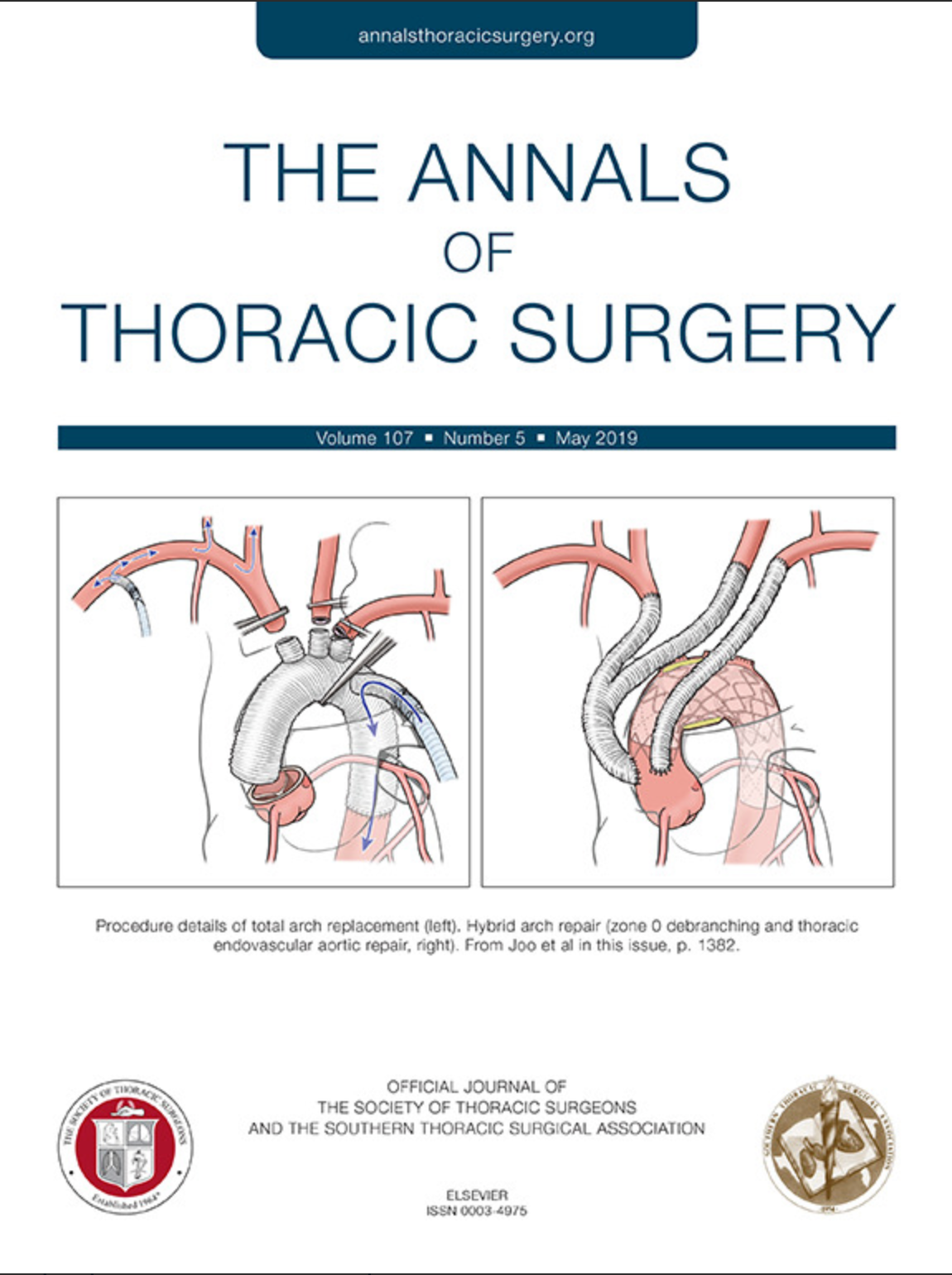 The Annals of Thoracic Surgery cover