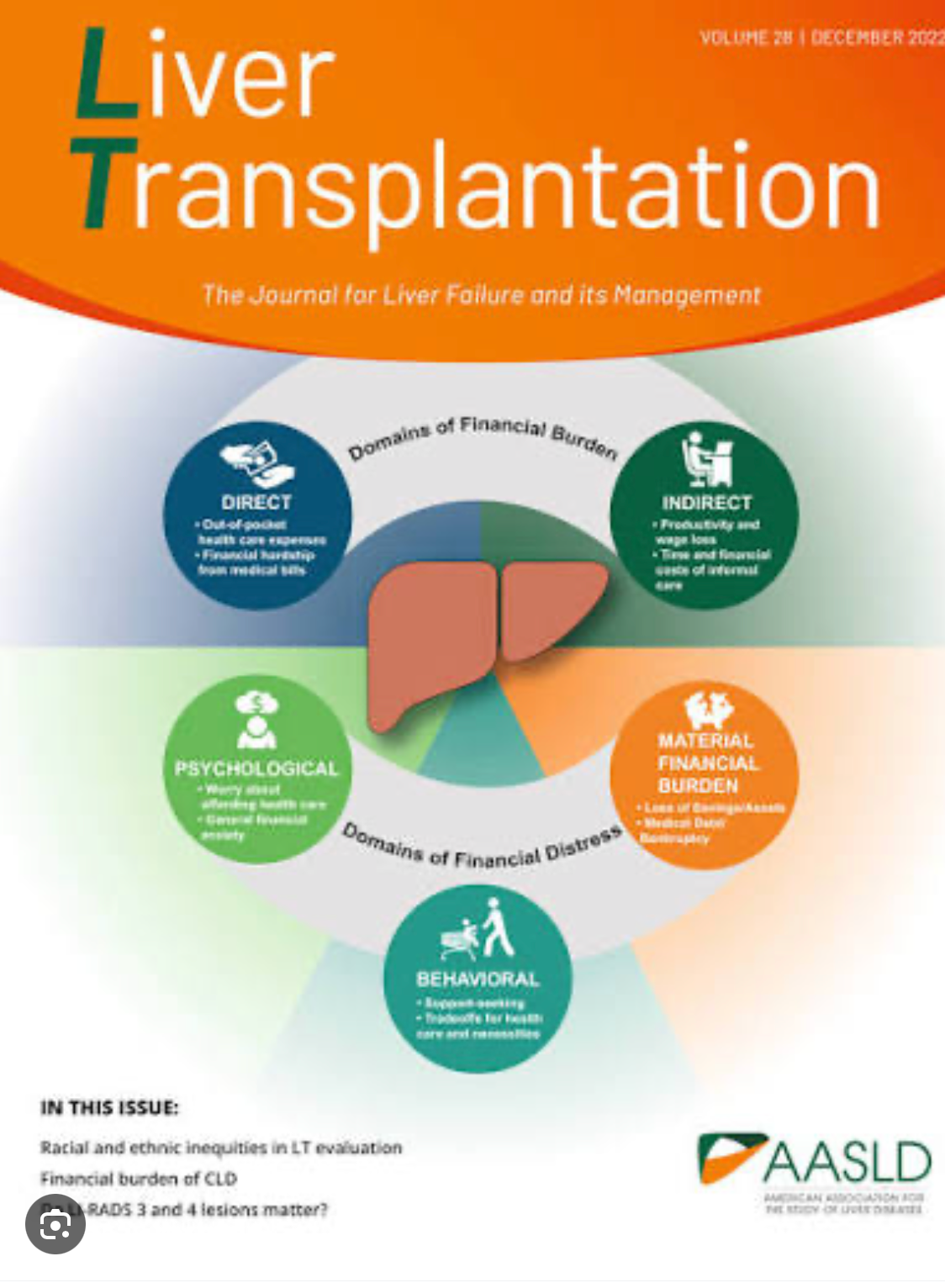 Liver Transplantation cover